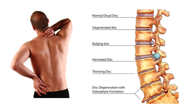 What are some ways to get relief from back pain?